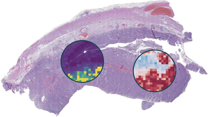 Histopathology slide with AI-based highlights of relevance and contribution for...