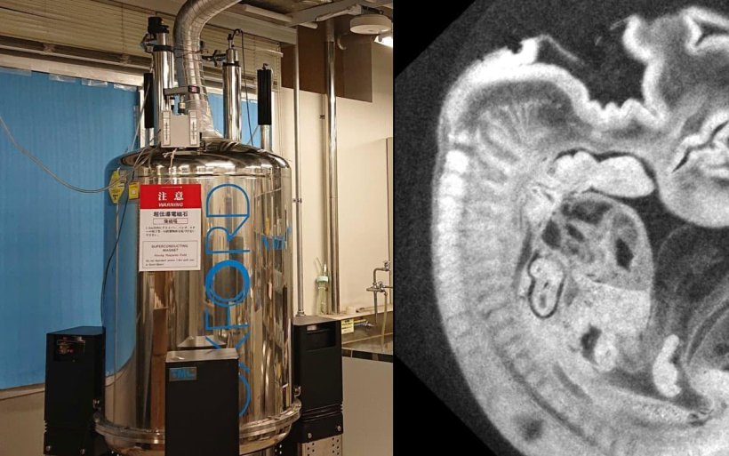 High-resolution MR imaging of embryos