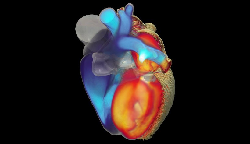 iHeart mathematical cardiac tool