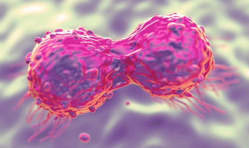 dividing breast cancer cells