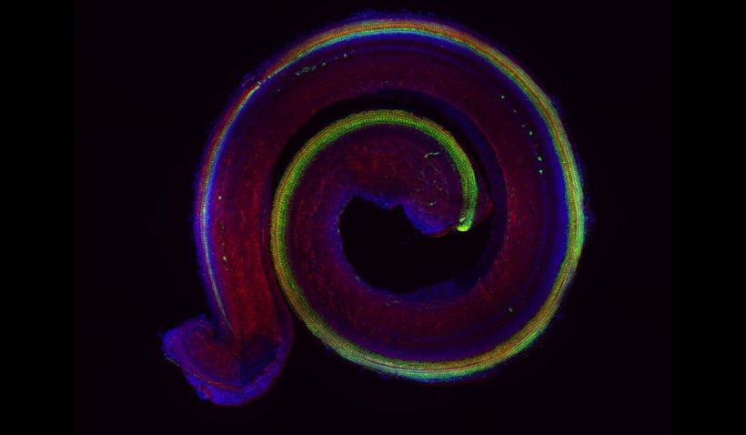 Fluoreszenzmikroskopische Aufnahme der Gehörschnecke einer Maus: In Grün sind...