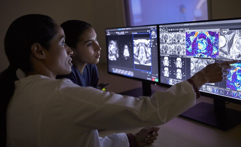 Philips partners with imaging biomarker specialist Quibim
