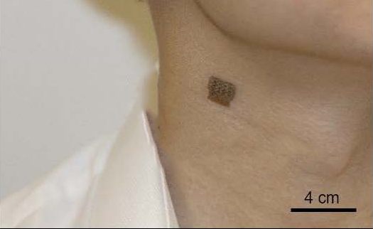 Breast cancer: In-bra ultrasound scanner to improve early detection •