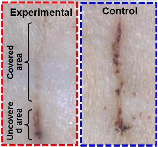 wound care bandages