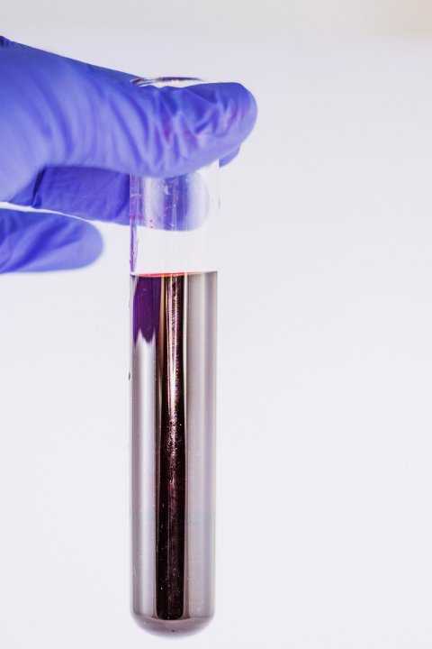 test tube, vial with blood