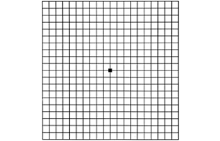 amsler grid