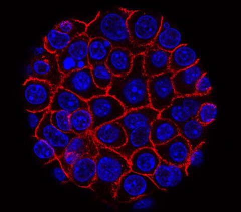 pancreatic cancer cells