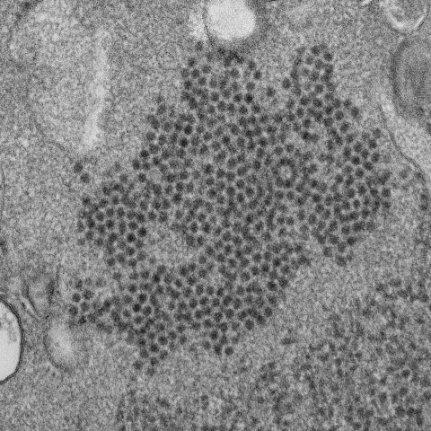 transmission electron microscopic (TEM) image of numerous, spheroid-shaped, Enterovirus-D68 (EV-D68) virions
