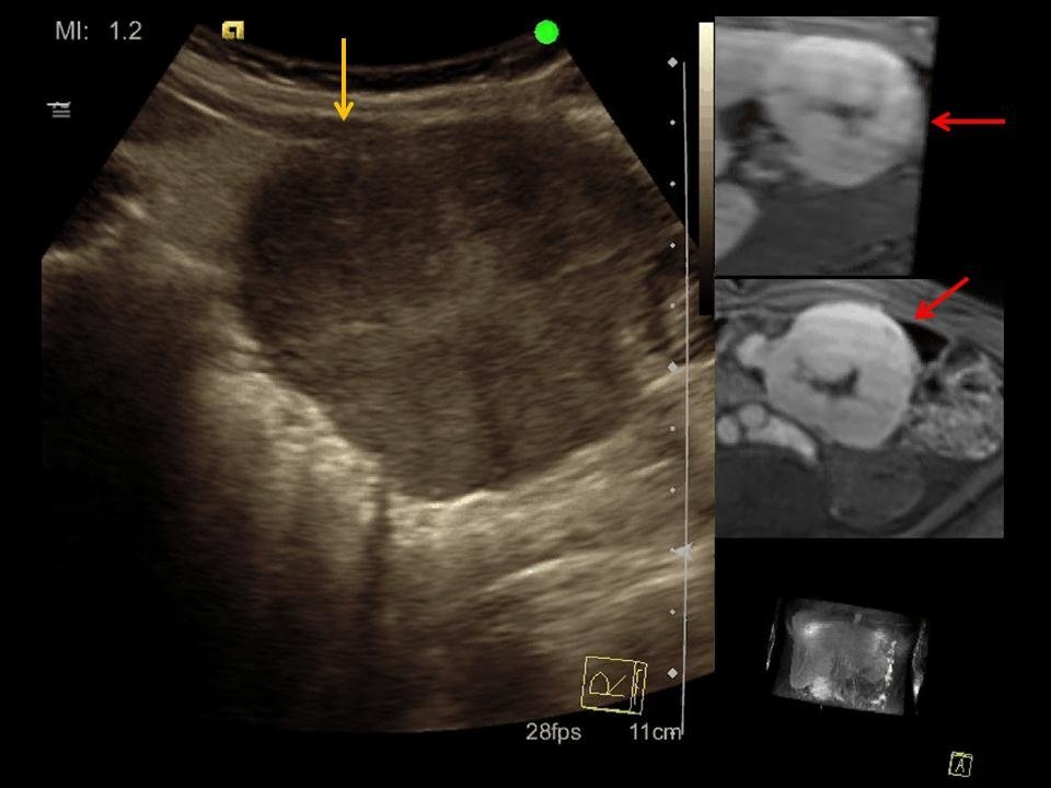 Sieht Man Magenkrebs Im Ultraschall healthcare-in-europe.com