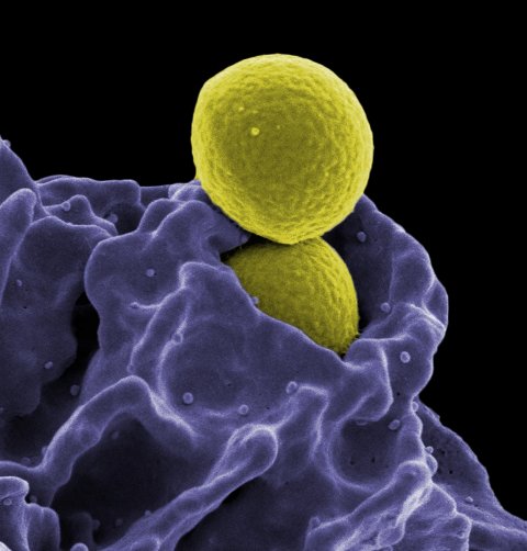 MRSA (yellow) being ingested by neutrophil (purple)