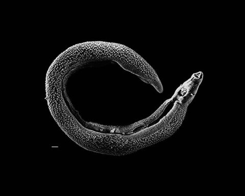 schistosoma