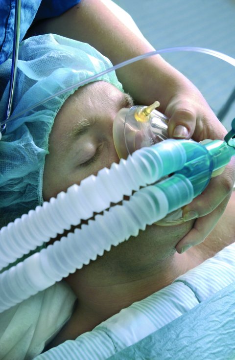 mechanical ventilation of a patient