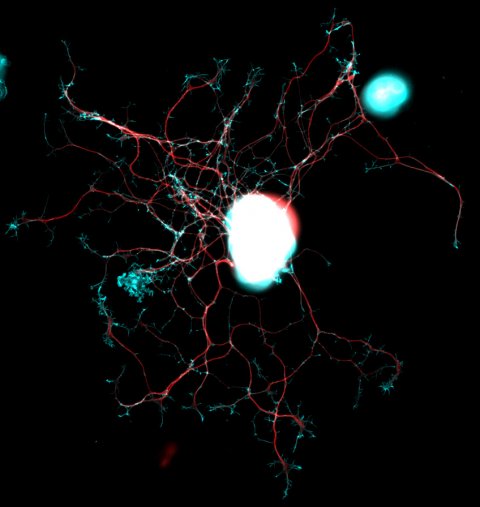 microscopic image of nerve cell