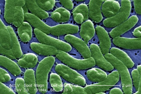 digitally-colorized scanning electron microscopic (SEM) image depicts a grouping of Vibrio vulnificus bacteria