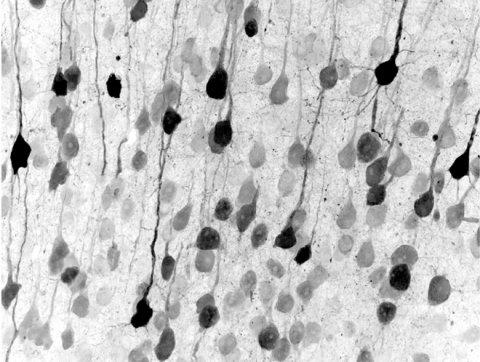 reprogrammed neurons of mural brain