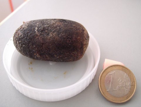 gallstone in small dish next to a 1 euro coin