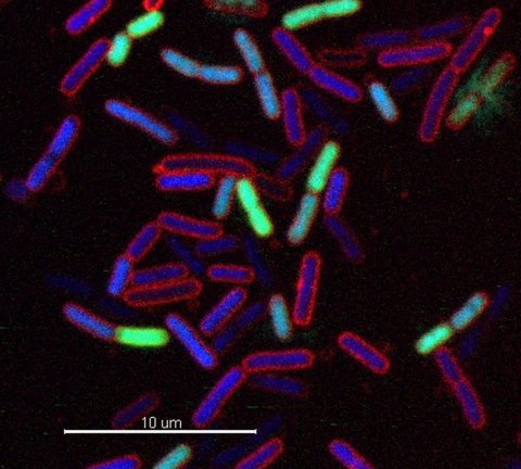 e.coli bacteria under fluorescent microscope