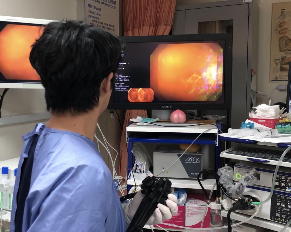 It’s time for colonoscopy and gastroscopy in 3D •