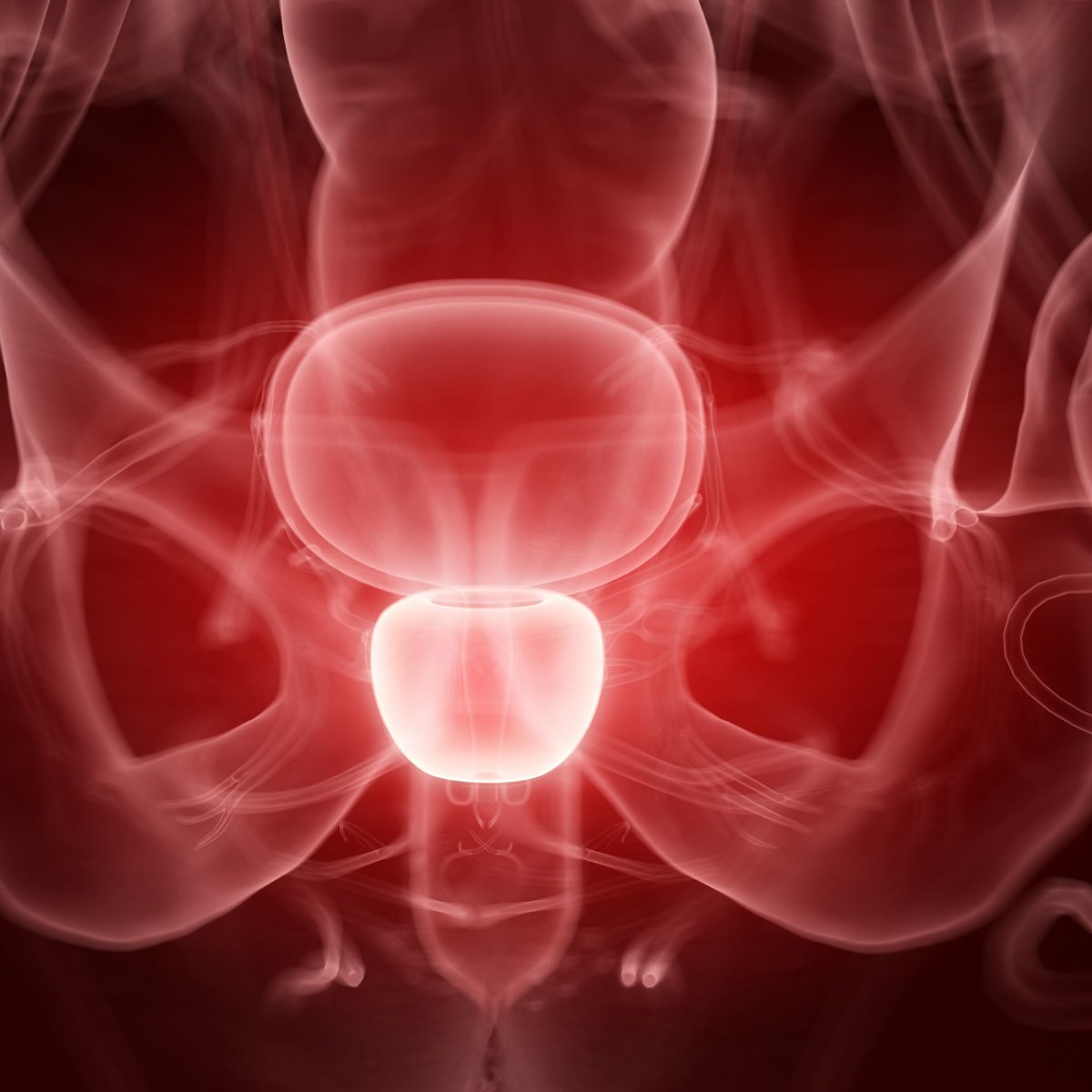 prostatita cu pietre la rinichi cumpără supozitoare rectale pentru prostatită