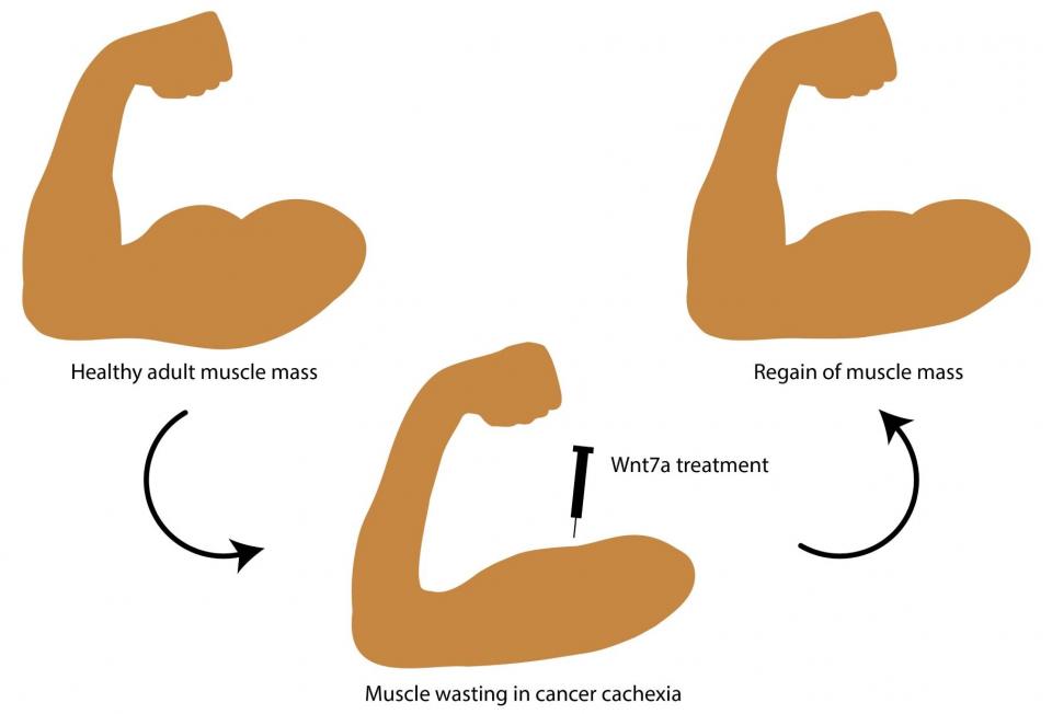 Cancer cachexia: Help against muscle loss • healthcare-in-europe.com
