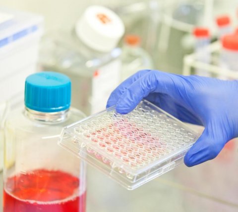 blue gloved hand holding a plate well in a medical laboratory