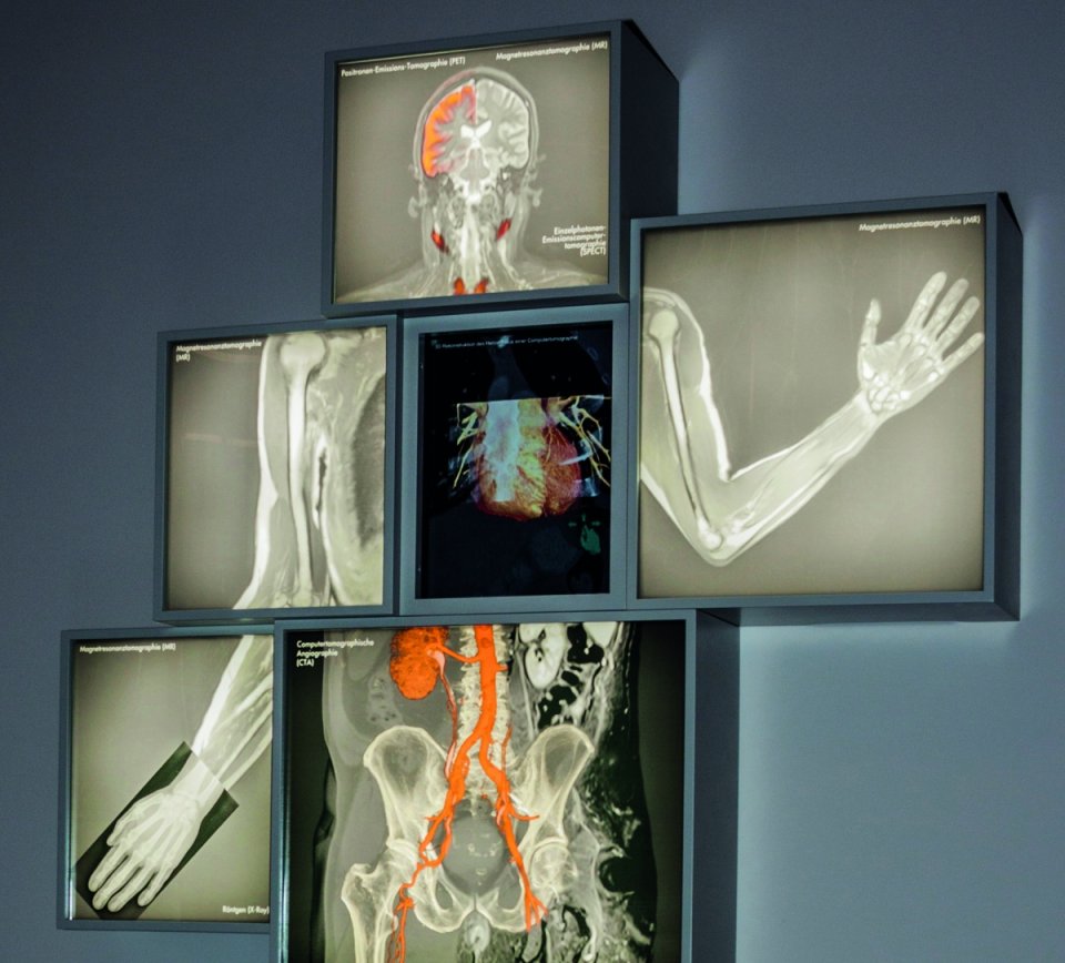 The €32 billion diagnostic imaging market at a crossroads • healthcare