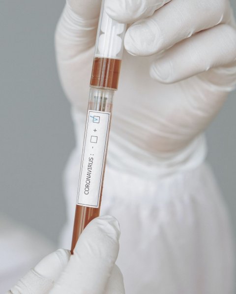 person wearing white gloves holding blood sample tube with coronavirus label