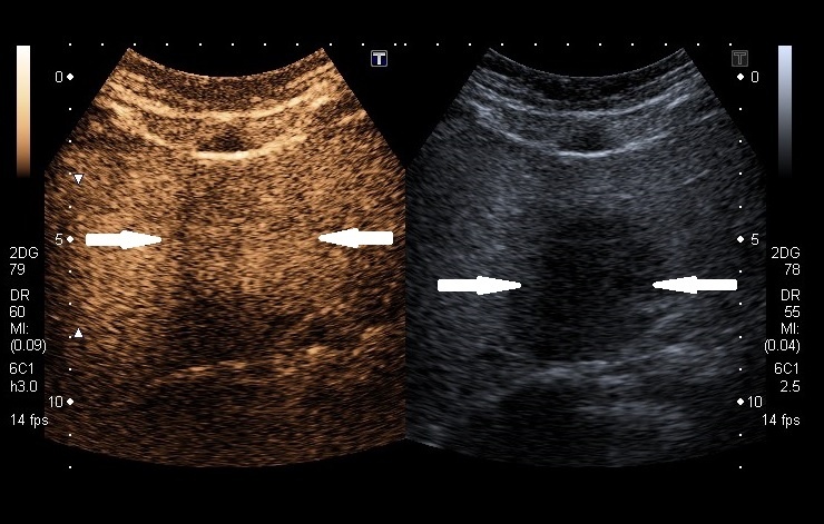 what-does-colors-mean-on-ultrasound-the-meaning-of-color