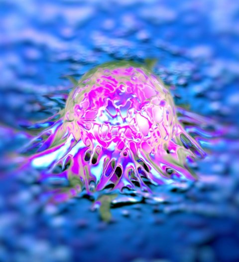prostate cancer cell illustration