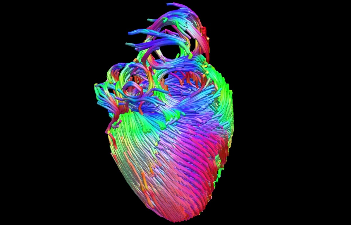 Diffusion Tensor Imaging