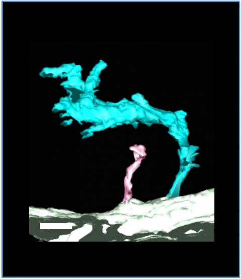 A ‘super-tubule’ (cyan) compared with healthy T-tubule (pink).