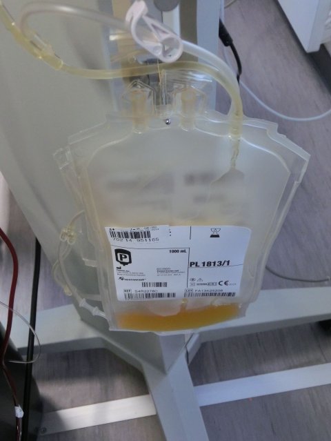 bag with blood plasma