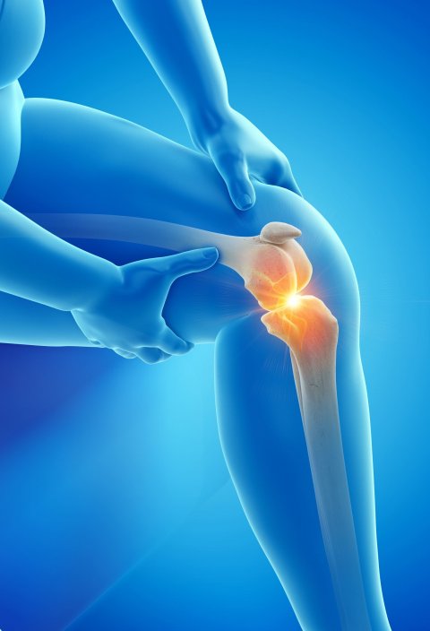 illustration of knee inflammation, pain