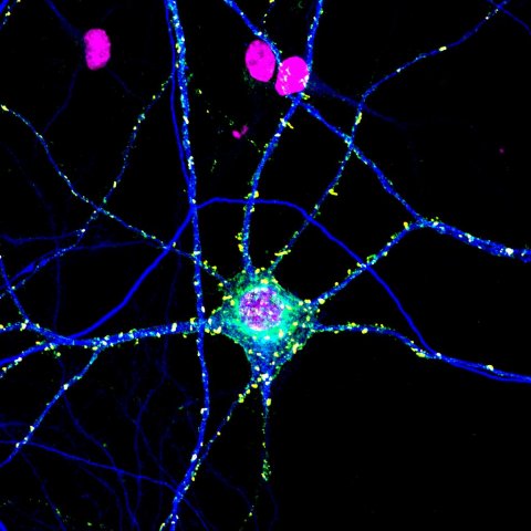 sinalling in neurons