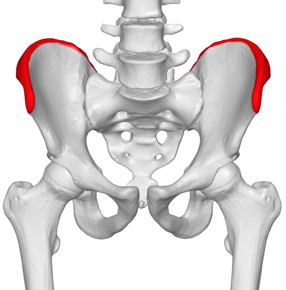 Iliac Crest Reconstruction 15 Patients Recruited Into GreenBRIC Study Iliac Crest Reconstruction 15 Patients Recruited Into GreenBRIC Study