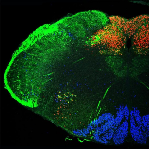 Transverse section of the hindbrain