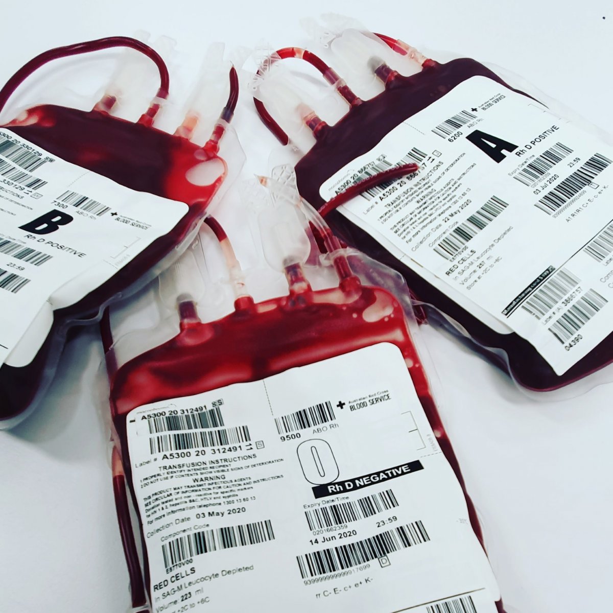 bloodless-transfusion-could-solve-global-blood-shortage-healthcare