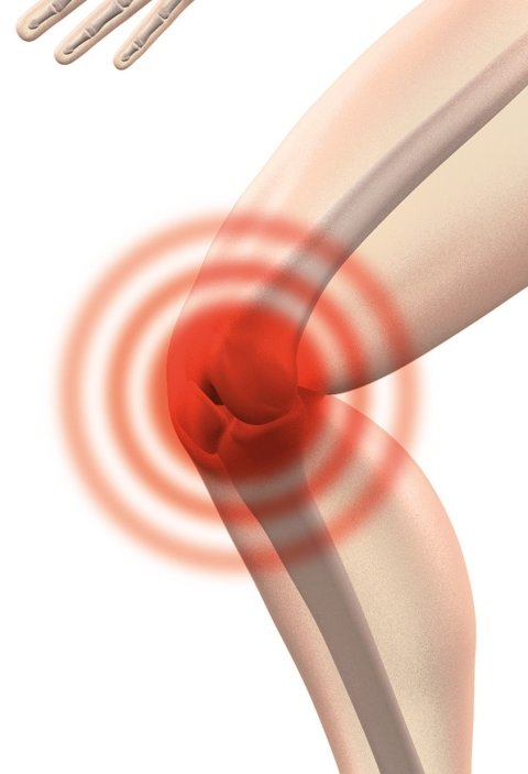 illustration of painful knee joint