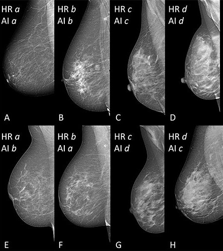 PDF) What is a large breast? Measuring and categorizing breast