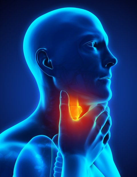 illustration of throat cancer, sore throat