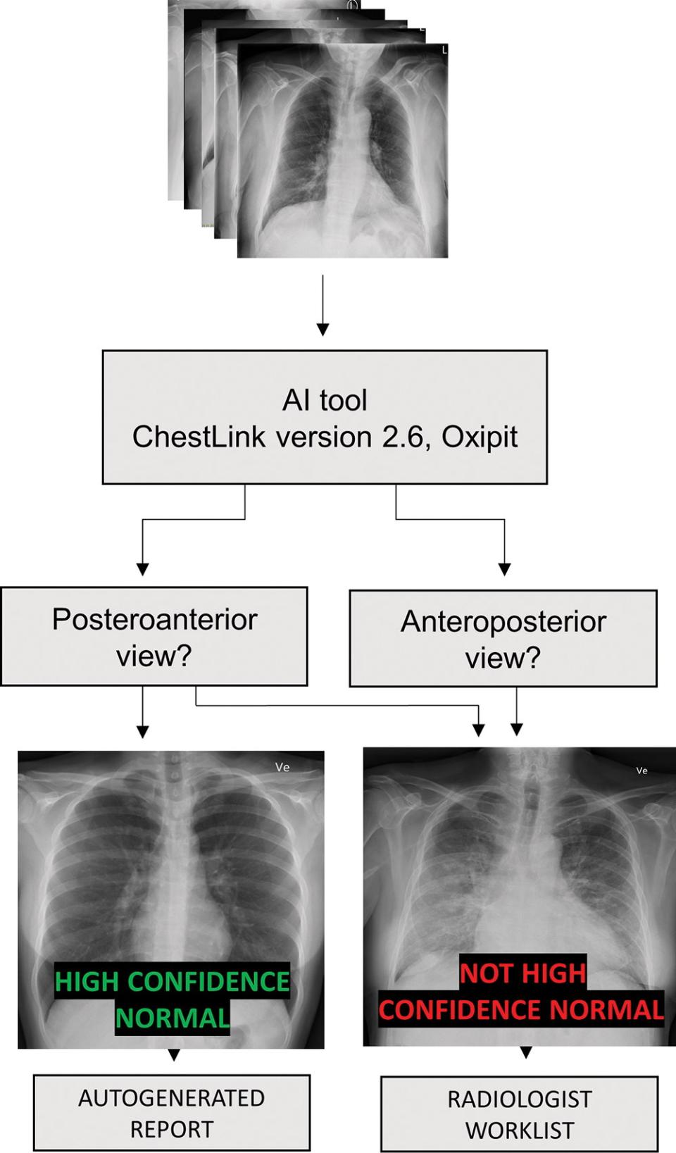 AI accurately identifies normal and abnormal chest Xrays • healthcare