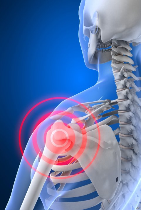 illustration of shoulder pain