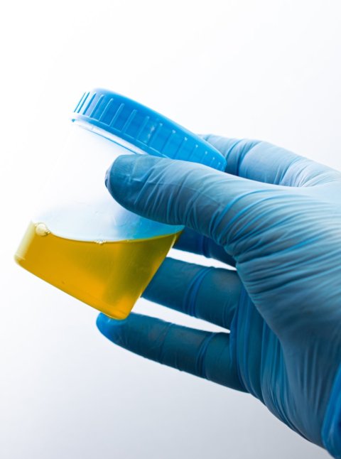 hand in blue rubber glove holding clear plastic container for urine test sample
