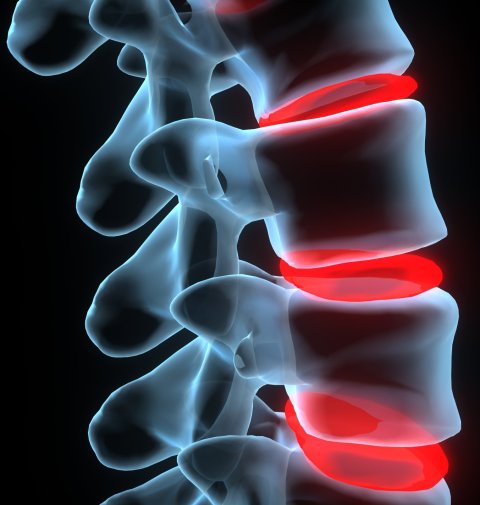 3d illustration of painful spine