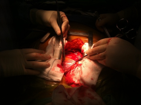 Herz-Operation