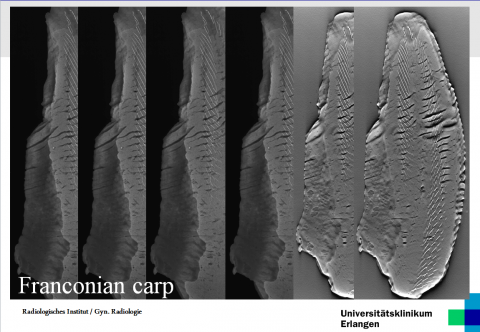 Tomosynthesis image