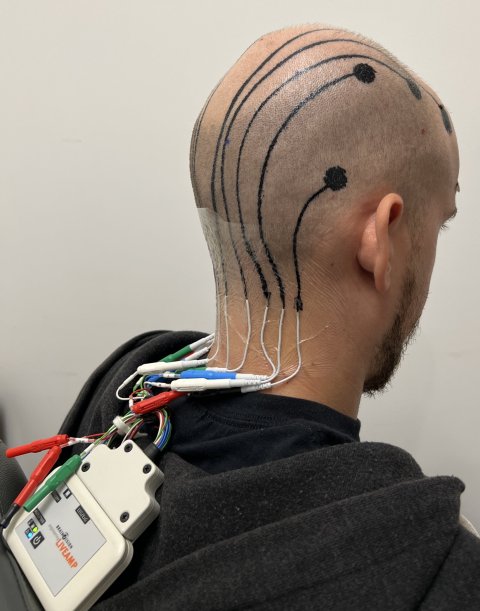 A man with shaved hair has black tattoo lines on his scalp, resempling electronic circuitry. These lines are connected to cables and other electronics positioned at the man's neck