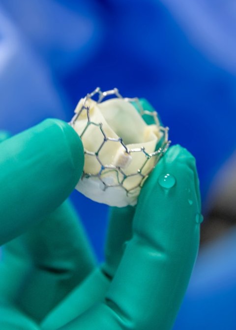 Closeup photo of a biological heart valve, held between finger and thumb of a hand in a green medical glove