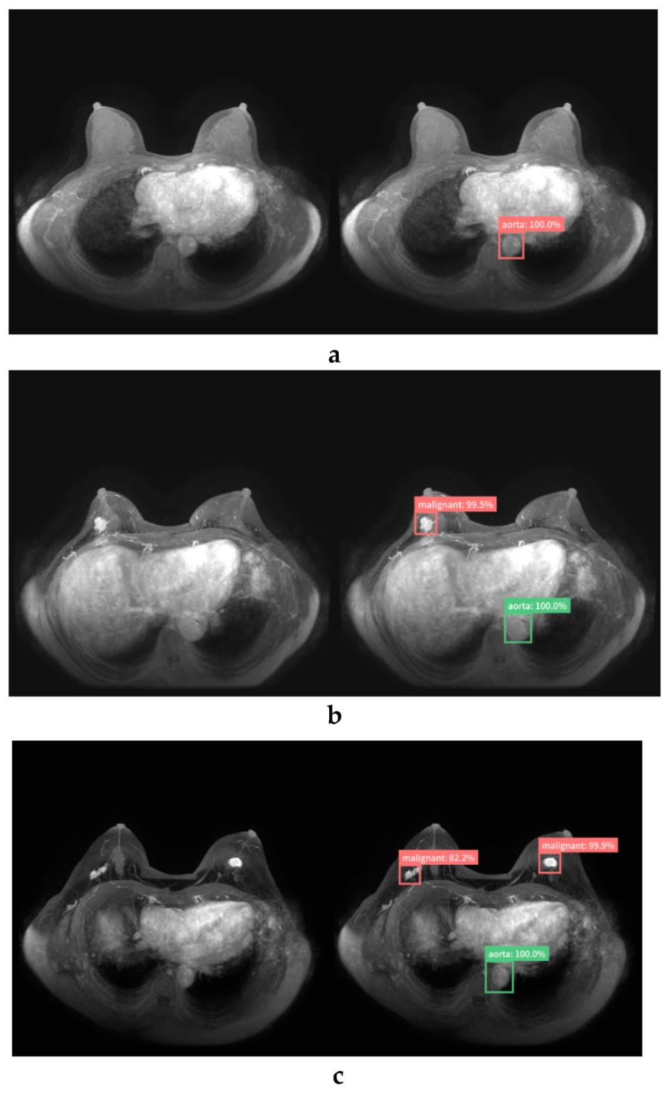 ‘The future of breast MRI is bright’ • healthcare-in-europe.com