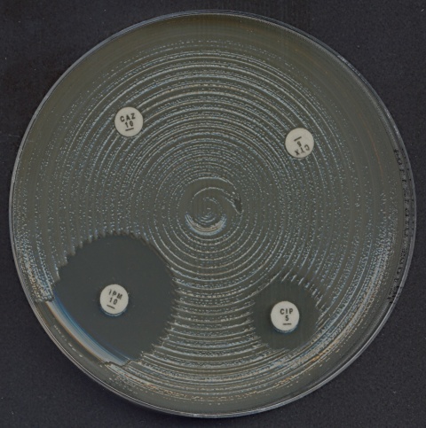Petri dish with multidrug-resistant (MDR) Klebsiella